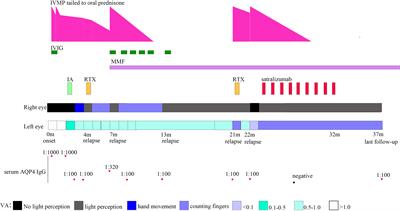 Satralizumab as an add-on treatment in refractory pediatric AQP4-antibody-positive neuromyelitis optica spectrum disorder: a case report